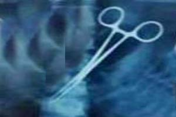 পনেরো বছর ধরে হজযাত্রীর পেটে কাচি!