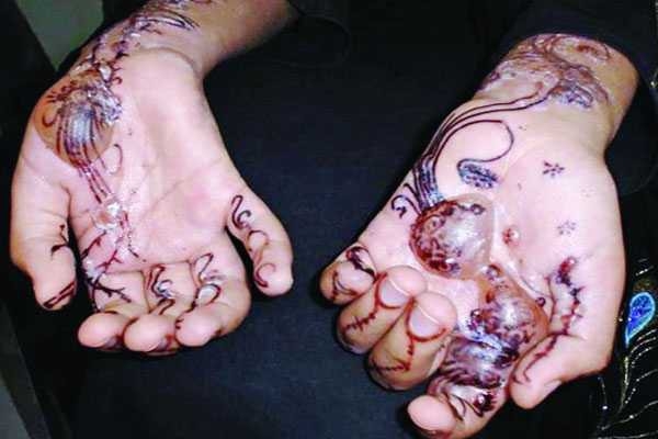 সাবধান মেহেদি ব্যবহারে!