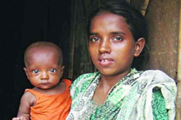 একটুর জন্য যে দেশে মরে ১০ লাখ শিশু!
