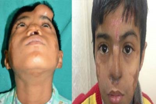 কপালে নাক, ঠিক জায়গায় আনলেন ডাক্তাররা!