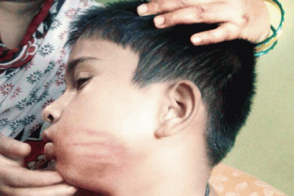 জিন তাড়াতে ছাত্রকে শিক্ষকের মারধর, অসুস্থ হাসিবুর