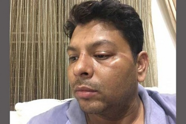 ‘আজ আমি গরিব বলে অভিনয় শিল্পীরা আমাকে অন্যায়ভাবে মারলো’