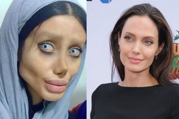 জোলি হতে গিয়ে ইরানের তরুণীর ৫০ বার অস্ত্রোপচারের খবর মিথ্যা!