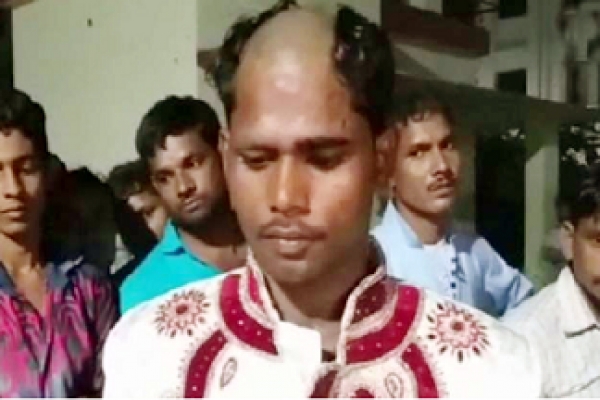  যৌতুক চাওয়ায় বরের মাথা ন্যাড়া করে দিল এলাকাবাসী!
