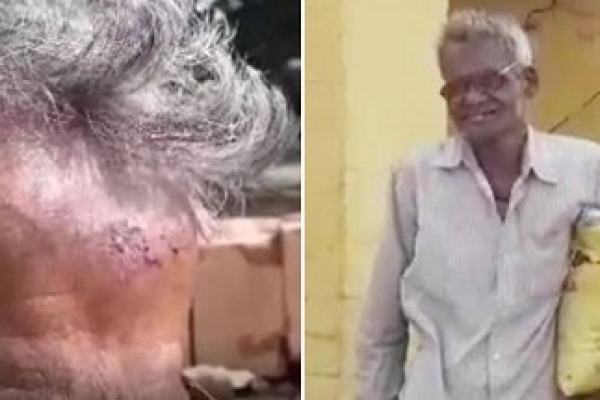 সম্পত্তি লিখে না দেওয়ায় ছেলেরা পিটিয়ে কপাল ফাটাল বাবার
