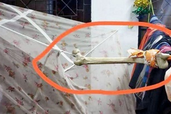 মেডিকেল কলেজের হোস্টেলে হাড়ে বাঁধা মশারি!