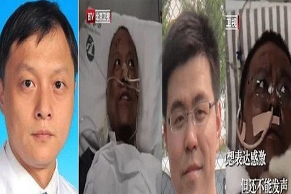 করোনাভাইরাস: ফর্সা থেকে কুচকুচে কালো হয়ে গেলেন দুই চিকিৎসক