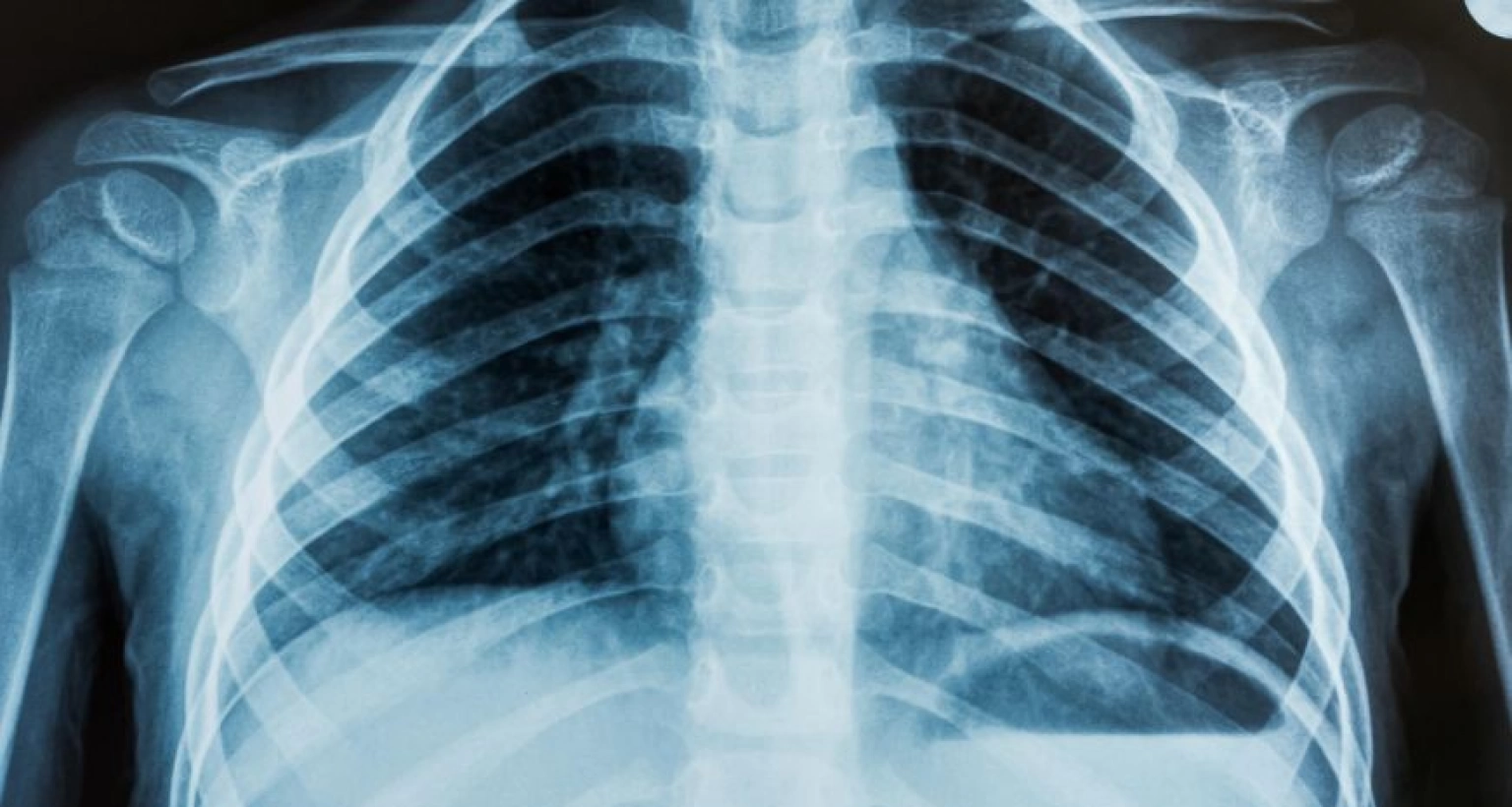 জানেন X-Ray এর আবিষ্কর্তা কে?