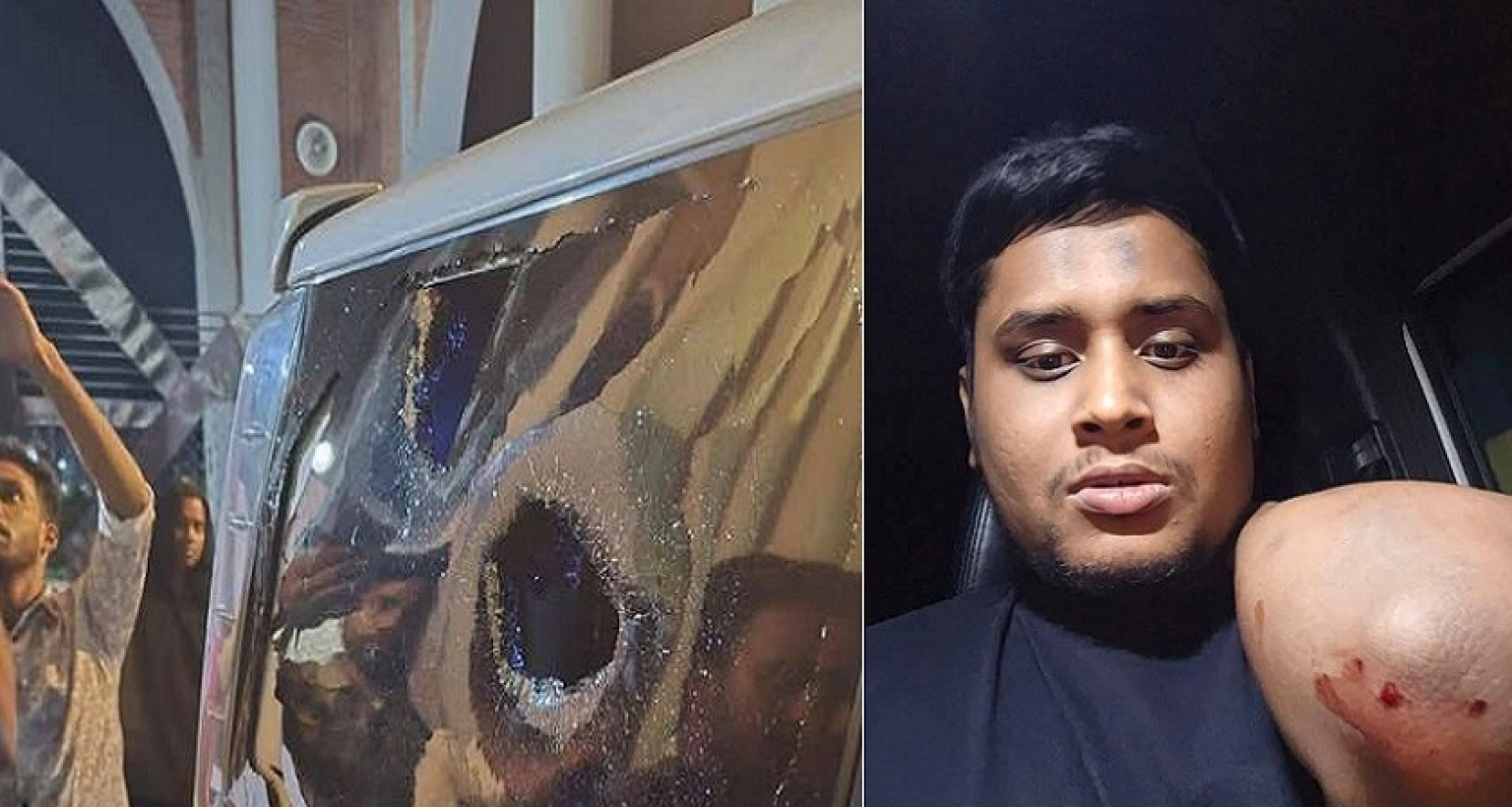 হাসনাত আব্দুল্লাহর গাড়িতে হামলা; সিসিটিভি ফুটেজ পর্যবেক্ষণ করছে পুলিশ