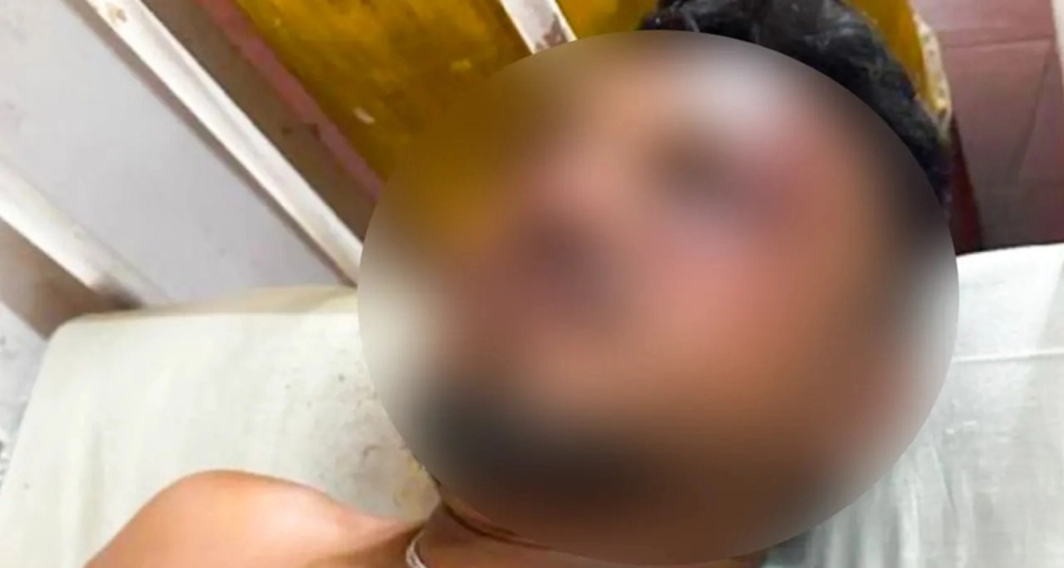 যখন উঠে দাঁড়াই, চারপাশে শুধু লাশ: বিমানের বেঁচে যাওয়া যাত্রী