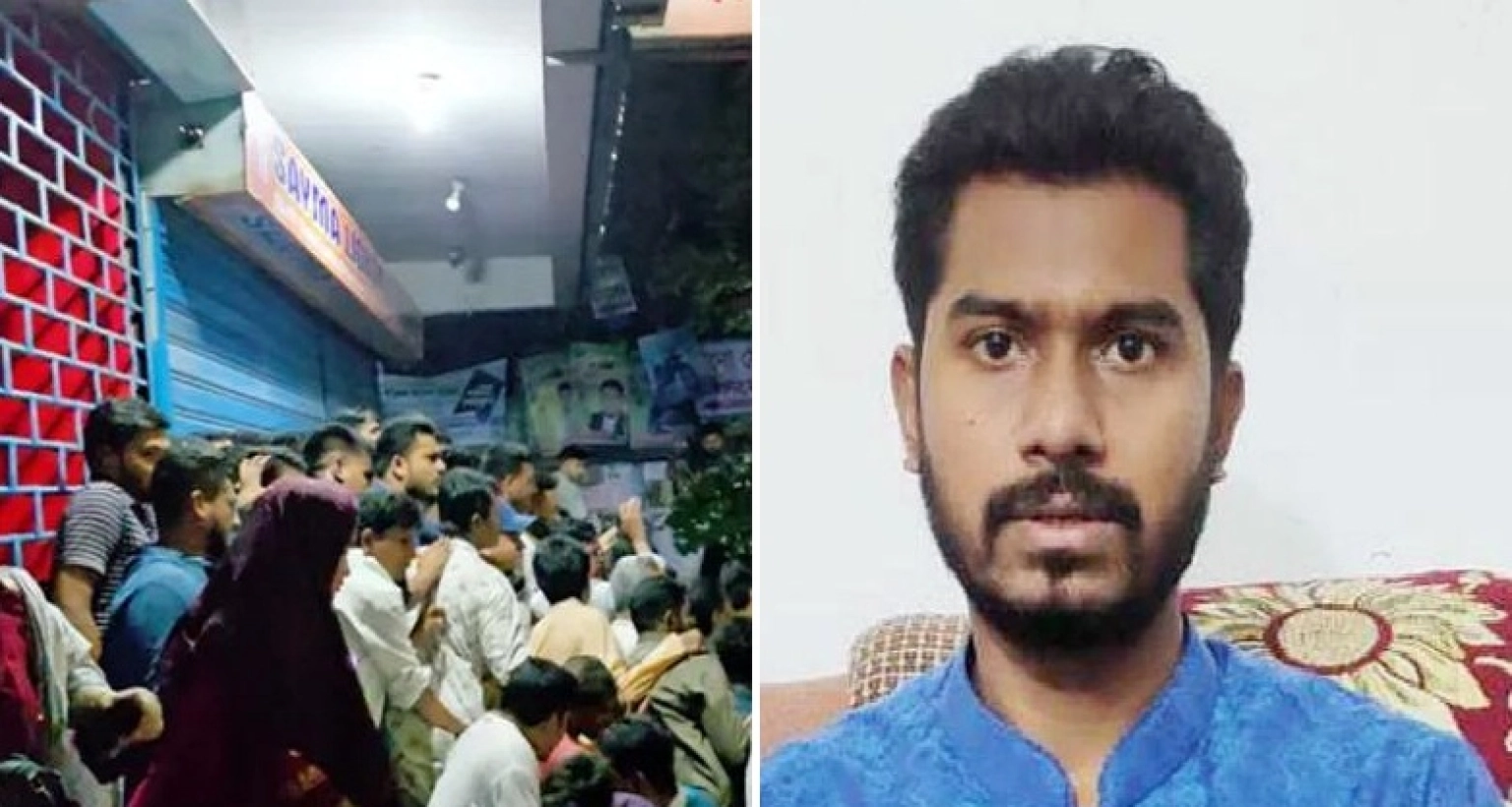 নুরের মাথা, নাক ও চোয়ালের হাড় ভেঙে গেছে, ভেতরে রক্তক্ষরণ!