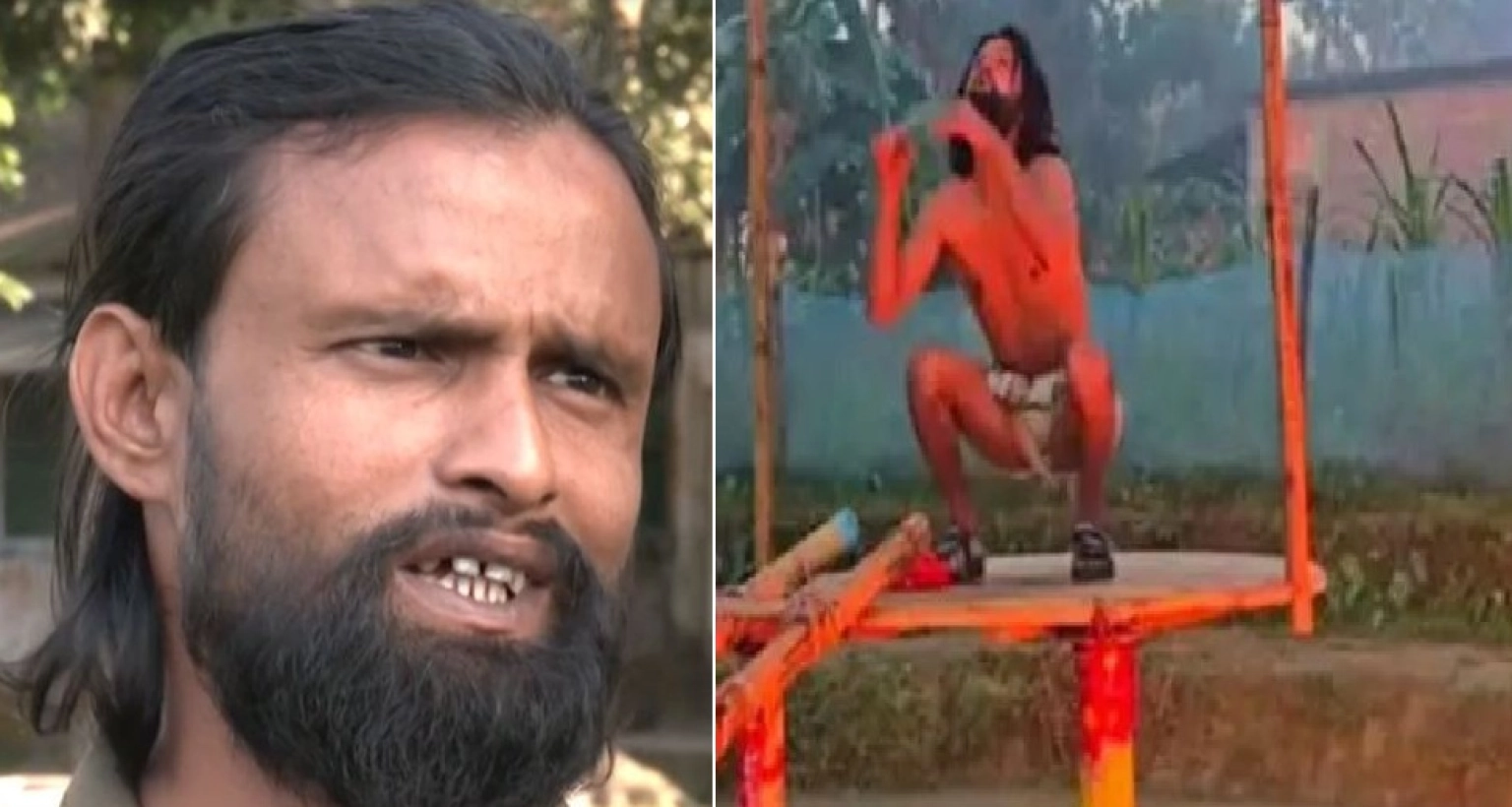 আগুনে আল-আমিনের শরীরের ৪০ ভাগ দগ্ধ, পরিবর্তন করা হয়েছে হাসপাতাল