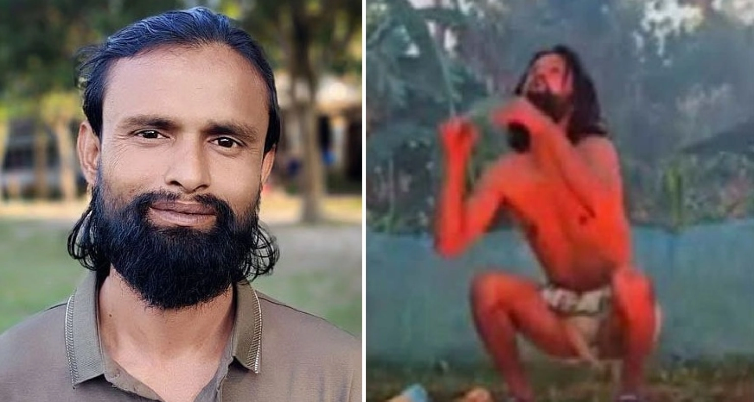 অগ্নিদগ্ধ আল-আমিনের অবস্থা সংকটজনক!