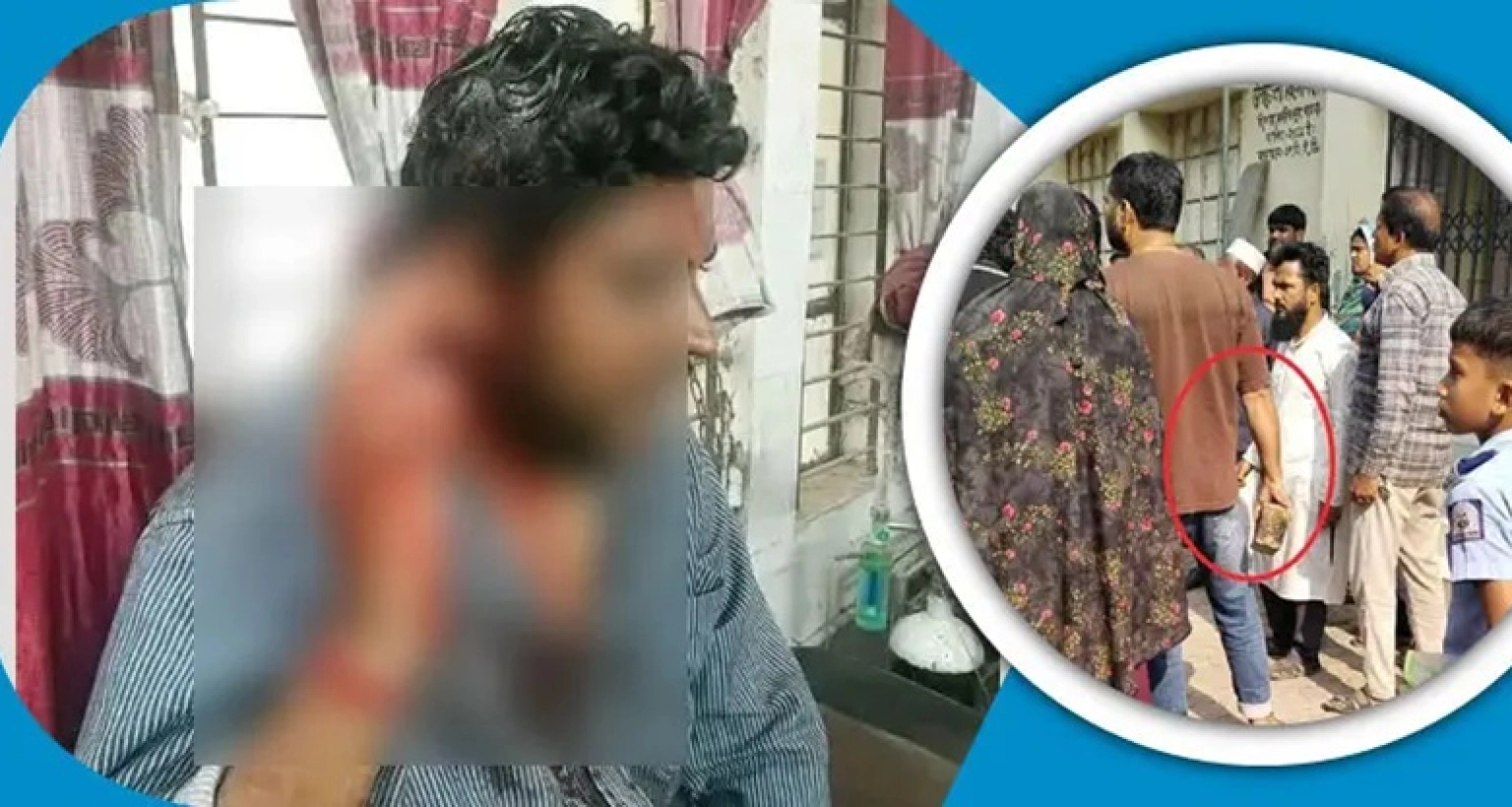 পরীক্ষা-না-নেওয়ায়-প্রাথমিক-শিক্ষকের-মাথা-ফাটালেন-অভিভাবকরা