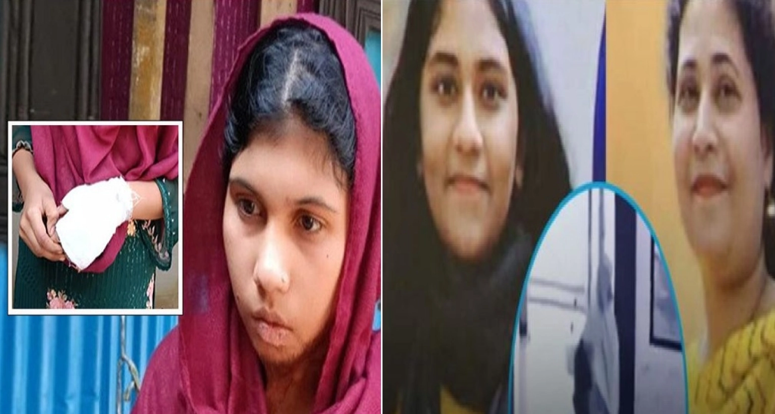 বাম হাতের কব্জিসহ তালু পর্যন্ত ব্যান্ডেজ সেই গৃহকর্মী আয়েশার