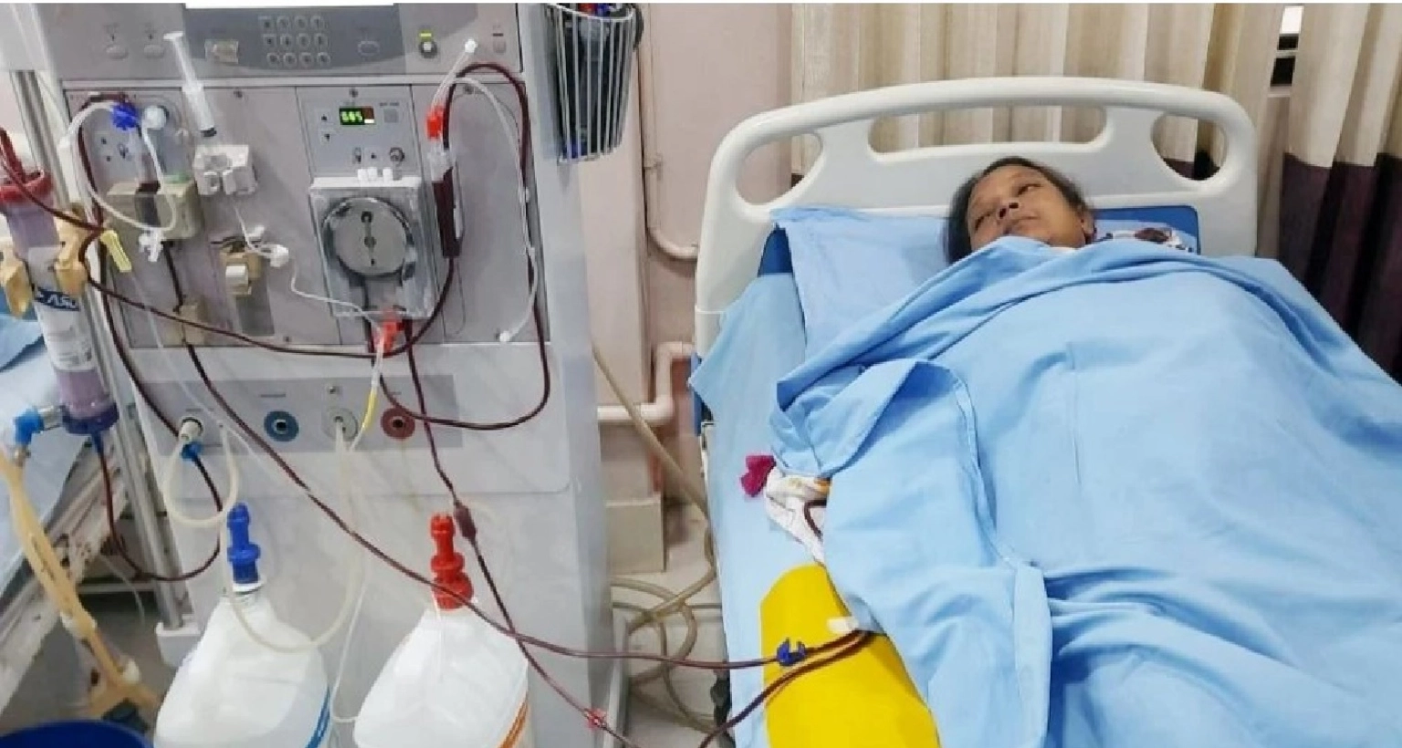 হাসিনার দুটি কিডনিই নষ্ট হয়ে গেছে