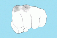 রিকশাচালকের ঘুষিতে দাঁত গেল যাত্রীর