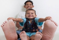 বিশ্বের সবচেয়ে বড় পা!