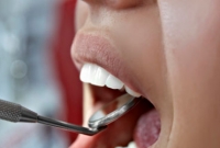 জানেন কি, মুখে ঘা হয় কেন?