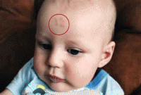 জন্মলগ্নে শিশুর কপালের চিহ্ন ১২, তোলপাড় বিশ্বে 