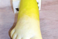 মানুষের পায়ের আকৃতির মূলা 