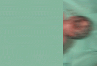 হাতির শুঁড়ের মতো নবজাতকের নাক