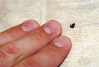 পৃথিবীর ক্ষুদ্রতম ব্যাঙ! 