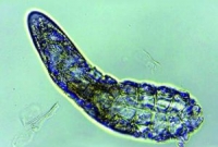 মানুষের মুখে ৮ পা-ওয়ালা কীটপতঙ্গের বাস