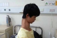 জিরাফগলা মানুষ