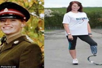 মৃত্যুঞ্জয়ী প্রথম 'বায়োনিক নারী'