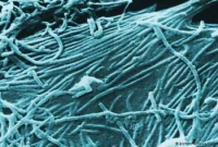 সবচেয়ে বিপজ্জনক দশটি ভাইরাস