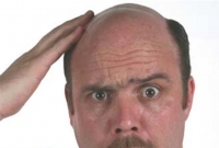 টাক মাথায় হৃদরোগের ঝুঁকি!