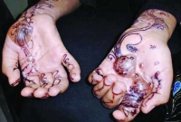 সাবধান মেহেদি ব্যবহারে!