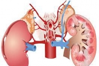 যেভাবে ভালো থাকবে ‘কিডনি’