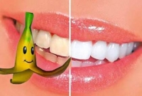 কলার খোসায় ঝকঝকে দাঁত 