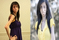 বিশ্বের সবচেয়ে পাতলা মানুষ 