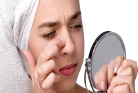 ১৫ ঘণ্টার মধ্যে ব্রণ সারিয়ে তোলার ৪টি সহজ উপায়