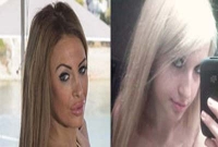 পুতুলের মত হতে দু’যুবতীর প্লাস্টিক সার্জারি, ব্যয় ২ লাখ পাউন্ড 