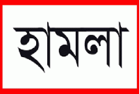 বিমানবন্দরে হামলা, নিহত ৫০