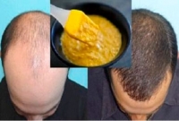 চুল গজানোর অবিশ্বাস্য ঘরোয়া পদ্ধতি