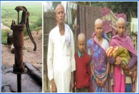 এ কেমন টিউবওয়েল? গোসল করলেই চুল উধাও, আতঙ্কে গ্রামবাসী!