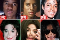 যেসব কারণে প্লাস্টিক সার্জারি করতেন মাইকেল জ্যাকসন