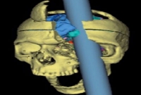 অবিশ্বাস্য, তবুও বেঁচে আছে মোহাম্মদ গুড্ড