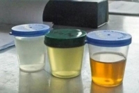 প্রস্রাব থেকে তৈরি হবে বিদ্যুৎ!