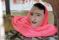 অর্ধেক নারী, অর্ধেক শিয়াল! চিড়িয়াখানায় উপচে পড়া ভিড়