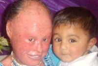 বিস্ময়কর, তবে সত্যি : সাপের মতো দিনে দুবার খোলস বদল করে নুসরাত