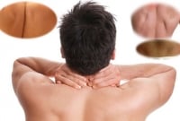 পিঠে এই জিনিসটি থাকলে আপনিও হবেন সৌভাগ্যবান!