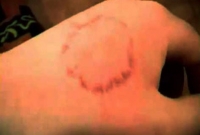 শ্বশুরবাড়িতে গিয়ে স্ত্রীসহ ১০ জনকে কামড়ালো জামাই!