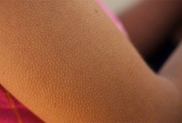 জানেন, ভয় পেলে বা ঠান্ডা লাগলে গায়ে কাঁটা দেয় কেন?