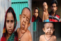 বাবা-মায়ের কোলে চার বছরের বৃদ্ধ শিশু!